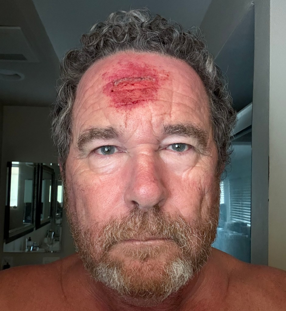 洛杉矶骚乱中，美媒摄影记者被橡皮子弹击中头部，并记录下这“恐怖一刻”  第2张